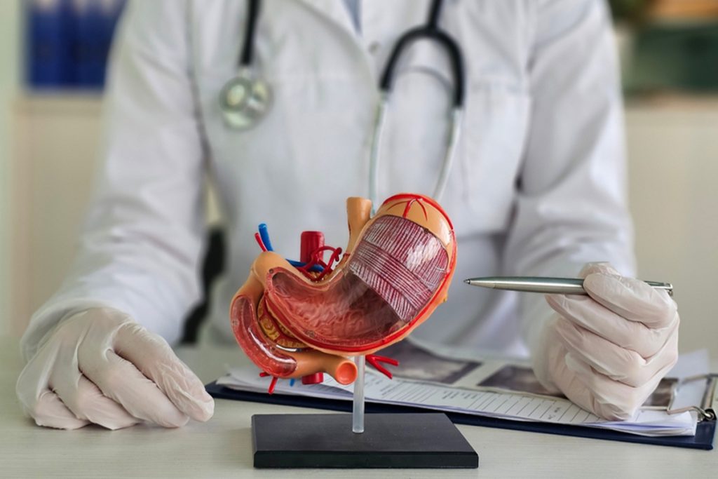 Bypass gastrico in Turchia