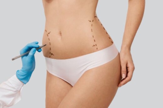 turchia-addominoplastica